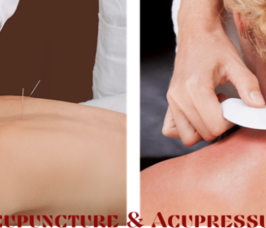 Acupuncture & Acupressure